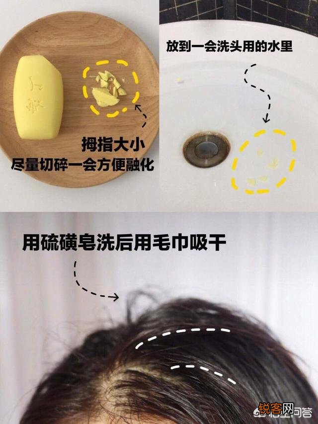 什么洗发水去油？我的头发很油,隔一天不洗就很油腻怎么办？