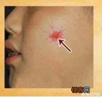 17岁高一女孩肚大如孕,去医院查出肝腹水！母亲痛哭：全都怪我啊！母亲做了什么？