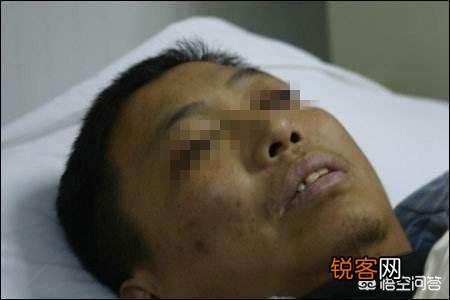 17岁高一女孩肚大如孕,去医院查出肝腹水！母亲痛哭：全都怪我啊！母亲做了什么？