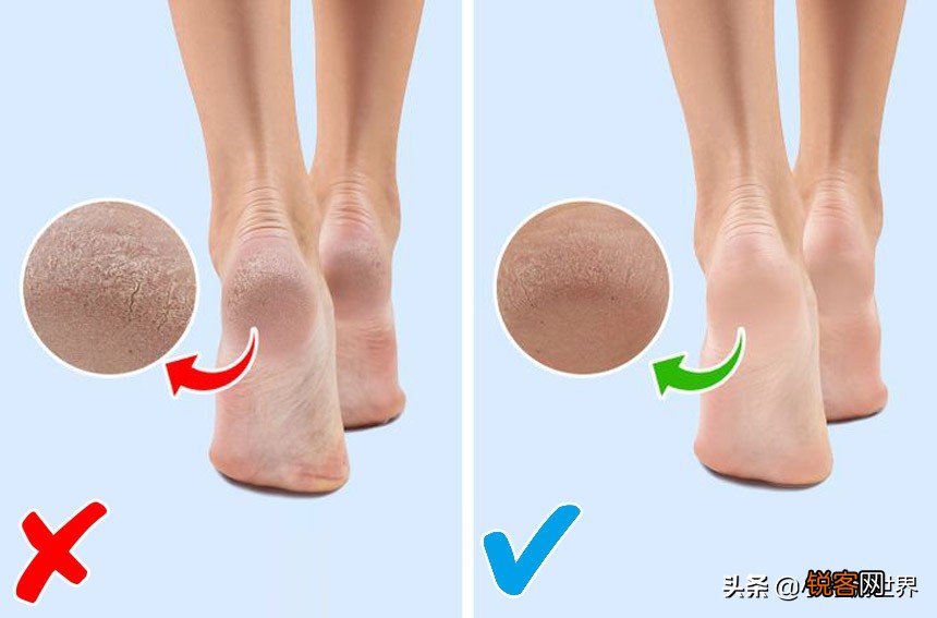 穿袜子睡觉好不好 晚上穿着袜子入睡可能带来5个好处