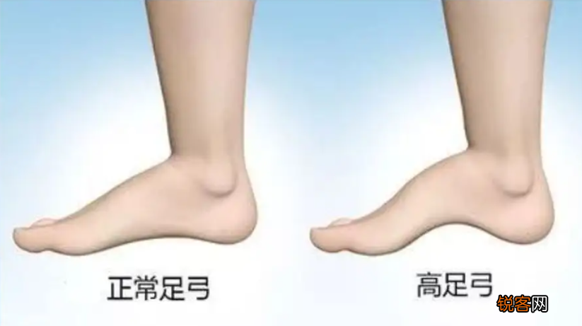 如何挑选适合自己的鞋子 教你如何根据自己的脚型,挑选ZUI合适的鞋子