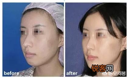 为什么很多女生正脸漂亮,侧脸却一般呢?