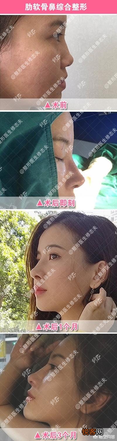 为什么很多女生正脸漂亮,侧脸却一般呢?