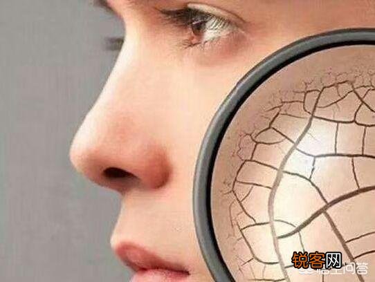 有没有适合32岁皮肤偏干又长斑女人的护肤品可推荐？