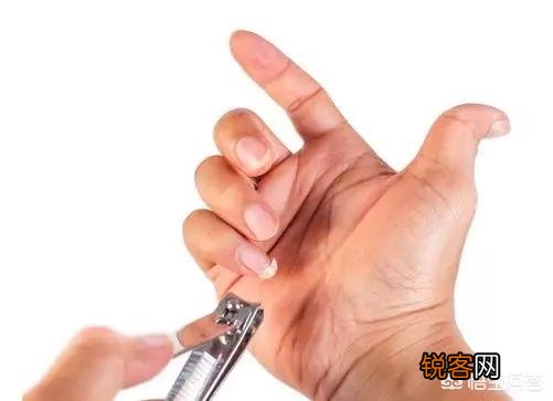 身上有小红痣,千万别大意,是大病的预警信号吗？