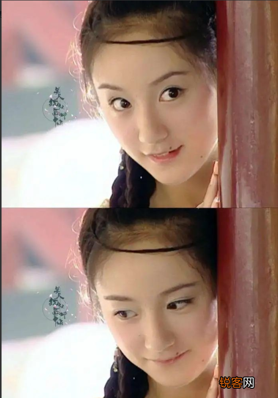 脸上什么部位的痣不能点 别再乱动脸上的痣了