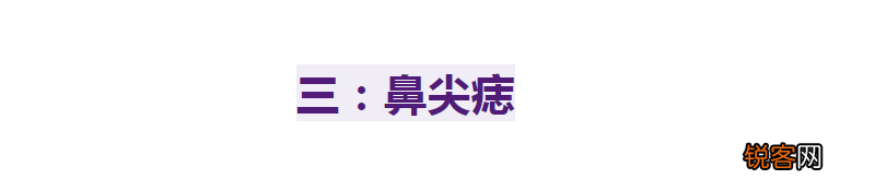 脸上什么部位的痣不能点 别再乱动脸上的痣了