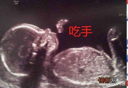 26周做四维彩超,图片显示宝宝在吃手是什么情况?