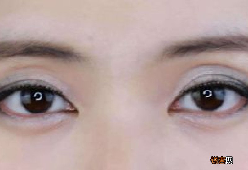 眼睛肿了是什么原因引起 眼睛肿与疾病有关吗