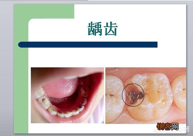 有什么速效方法缓解牙痛吗?