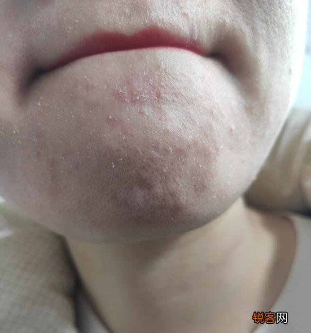 皮肤好到吹弹可破,是一种怎样的体验？