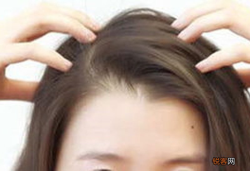 每天掉头发怎么回事 每天掉头发要怎么治疗