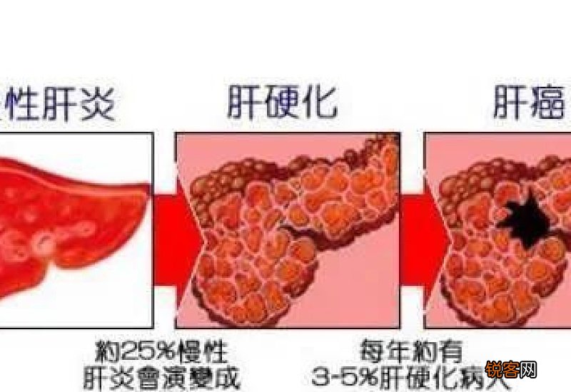 晨起后的这些表现，说明肝脏需要帮助，你收到信号了吗？