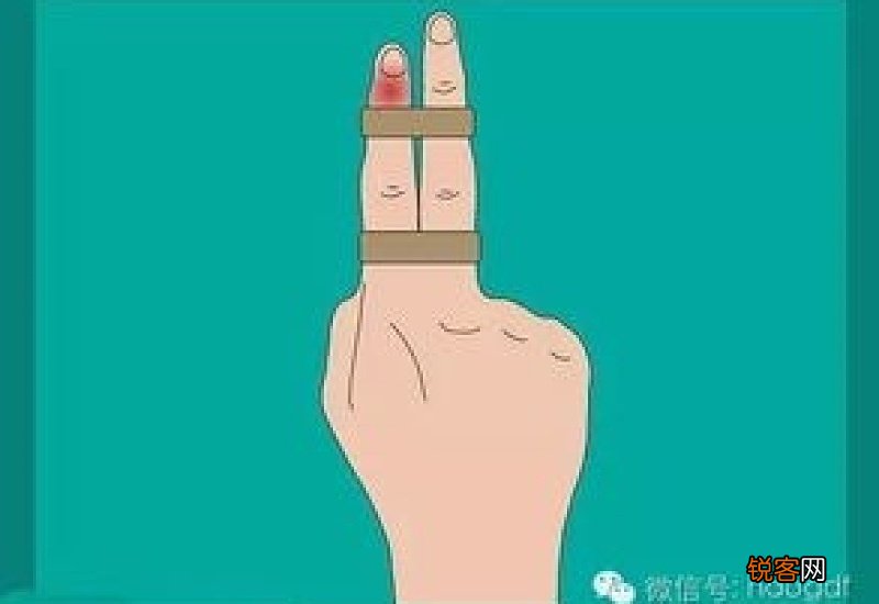 打球手指戳伤怎么办 打球戳到手指怎么办