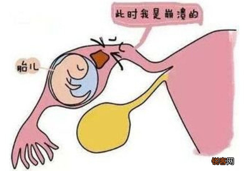 刮宫后要注意什么？刮宫后注意事项