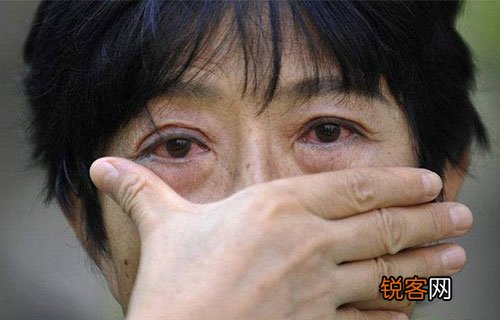 招致红眼病的病因有哪些 红眼病怎样传染的