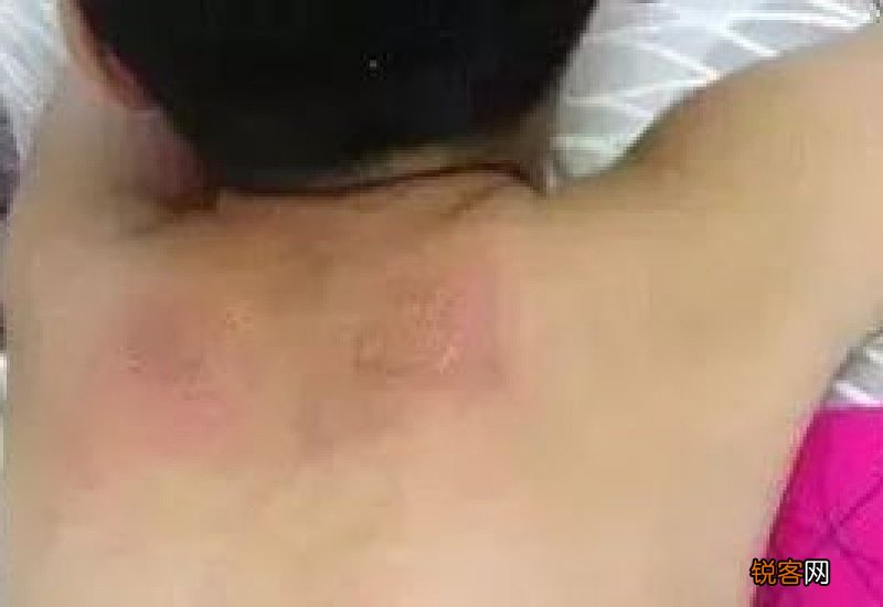 不在三伏天贴三伏贴行吗