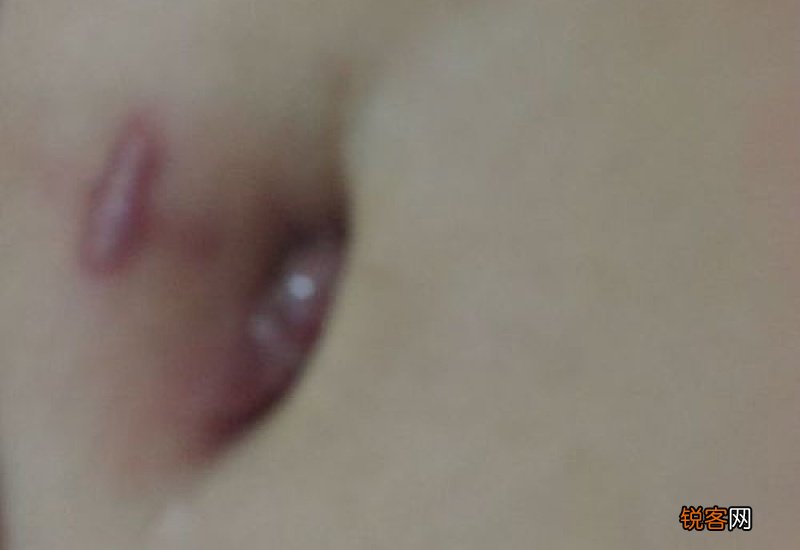 肚脐眼周围疼怎么回事 肚脐旁边痛是怎么回事