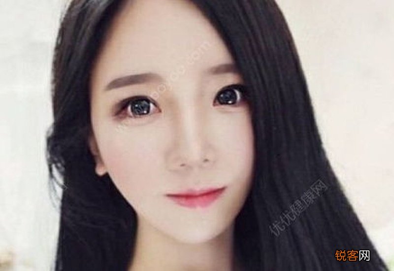什么样的唇部需要整形 唇部整形有什么要注意