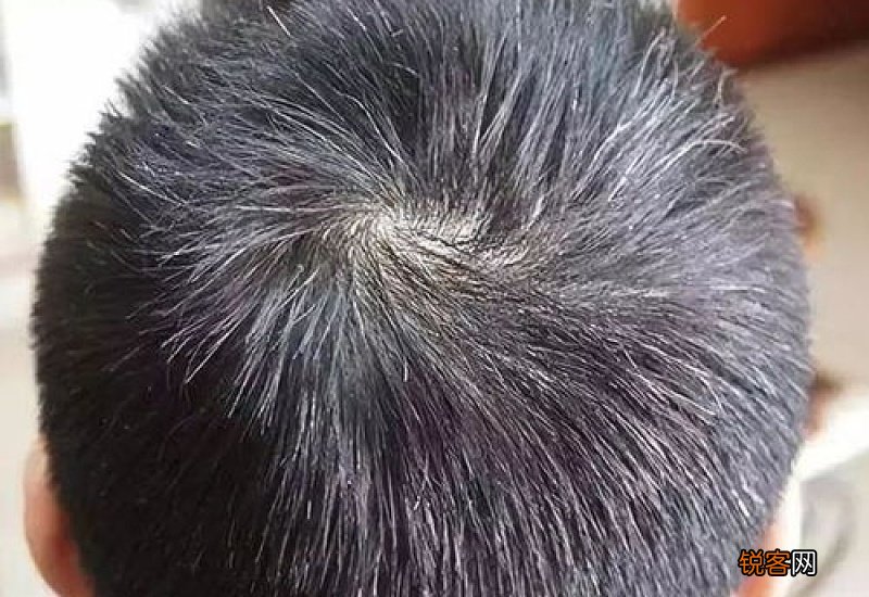 白头发多怎么办 白头发多吃什么食物好