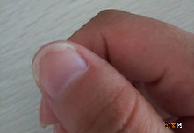 指甲空了不连肉怎么办