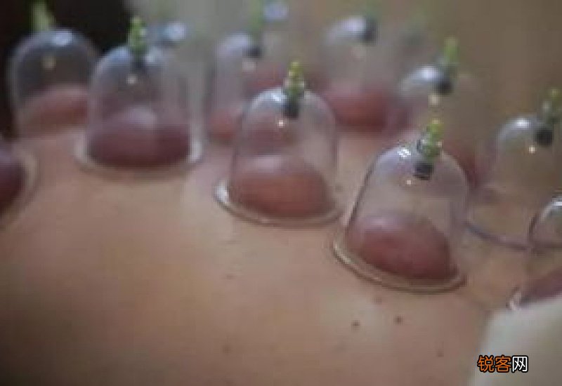 拔血罐有什么坏处