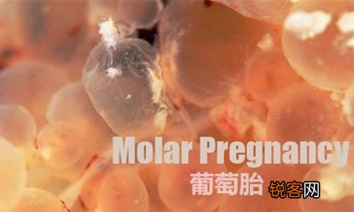 你晓得什么是葡萄胎吗 呈现这些症状千万要警觉