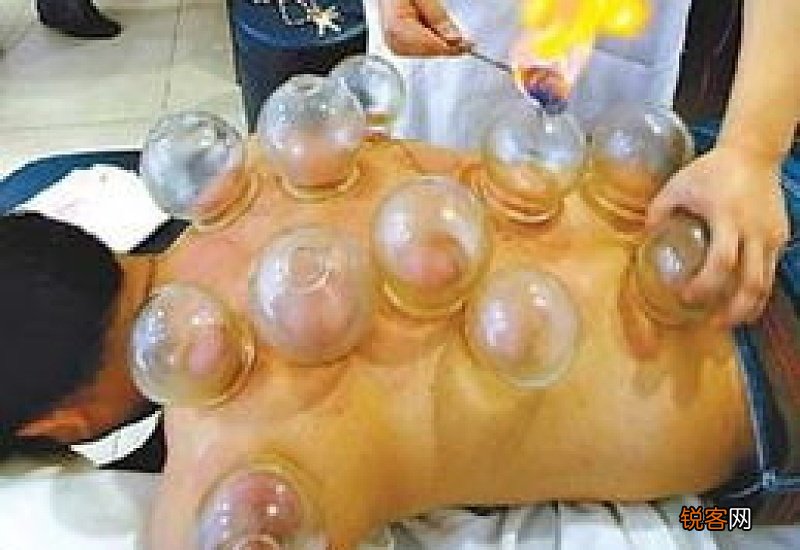 男不刮痧女不拔罐什么意思