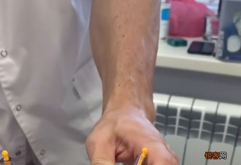拔罐拔出血水是什么原因 拔罐拔出来的血都是血块是什么原因