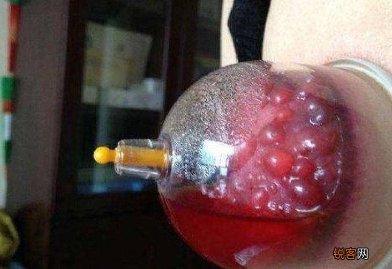 三九天可以艾灸吗