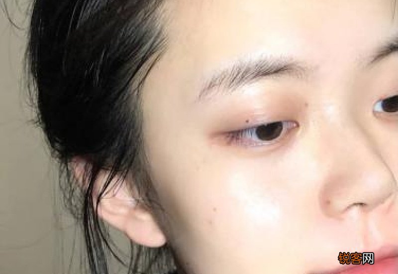 涂了防晒没过多久脸变黑