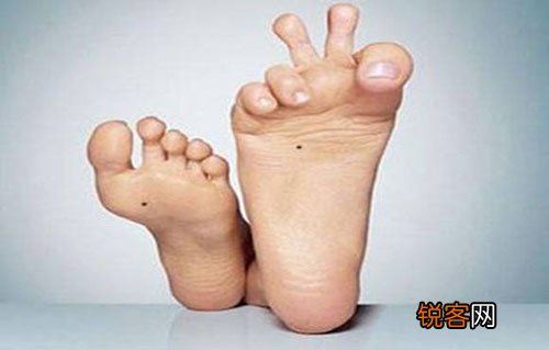 跖疣会传染吗？跖疣是经过哪些途径传染的？