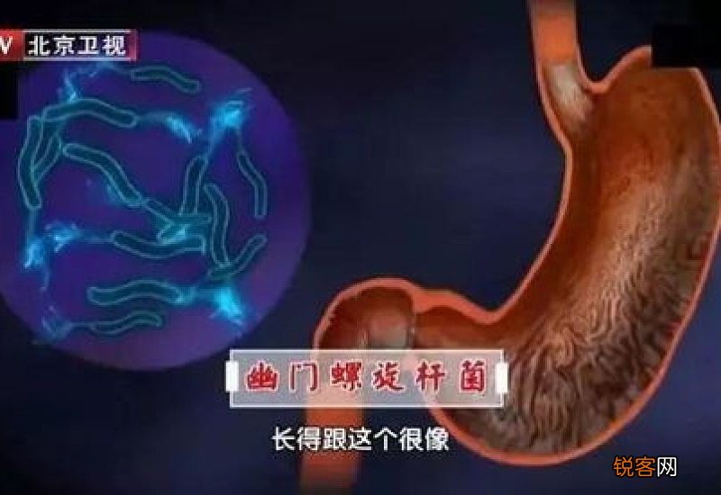 如何杀死幽门螺旋杆菌