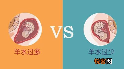 羊水过多有什么发病机制 羊水过多怎样办