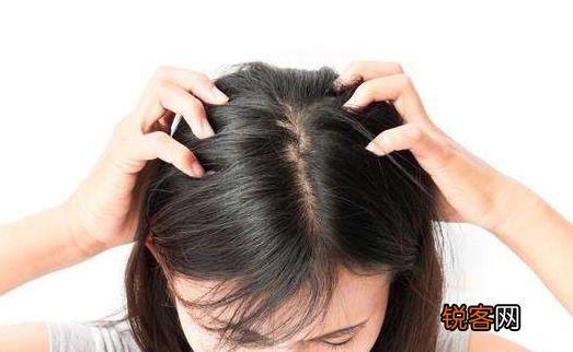 女性脱发的八大原因 防脱发的食谱来预防