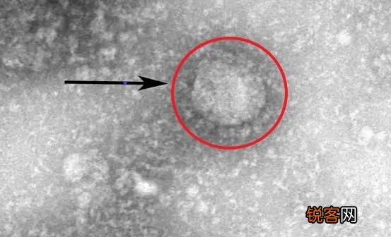 预防新冠病毒忌口有四 家里勤消毒助力抗疫早日成功