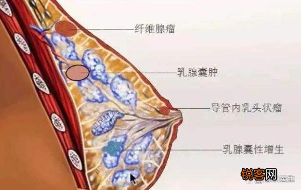 乳头疼是怎么回事是什么原因引起的44岁女性