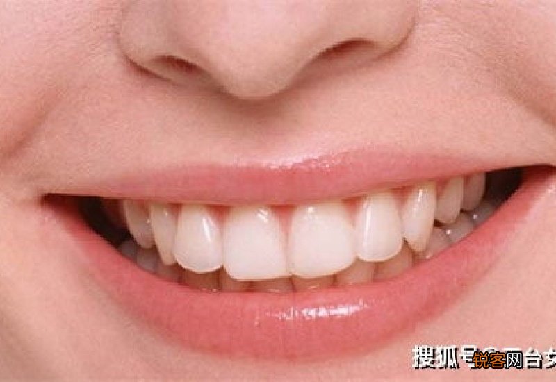 什么方法可以美白牙齿
