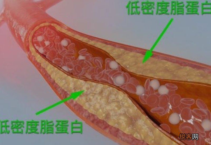 体检时查出低密度脂蛋白偏高的人，平时尽量要远离这5种食物