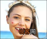 不同部位长痘 预示不同脏器上火