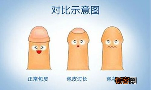 包茎男性平常应该留意些什么 包茎的留意事项