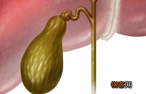 胆囊癌晚期有4个不分明症状！你能够一个都不晓得