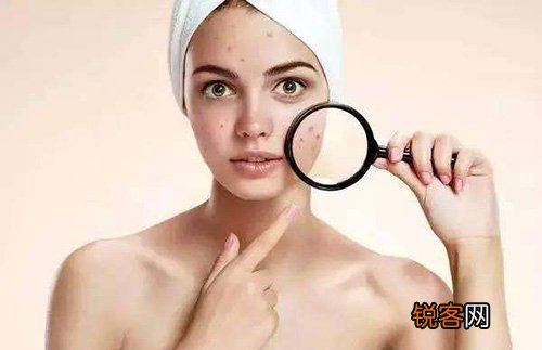 扁平疣是怎样惹起的？扁平疣最佳医治办法
